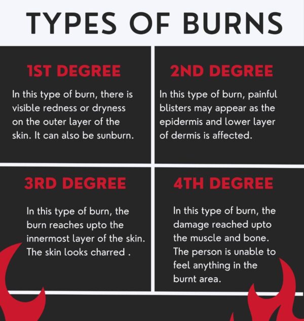 Types of burns