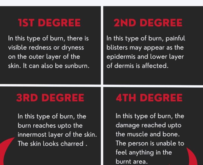 Types of burns