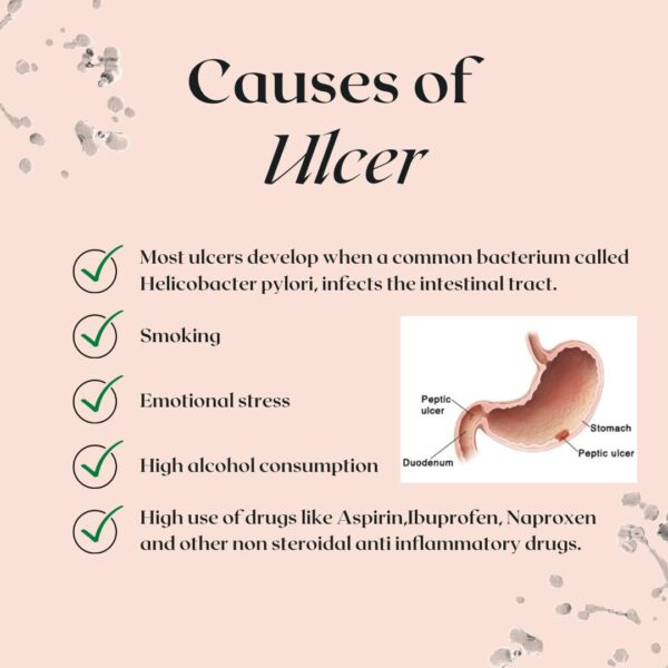 Causes of ulcer