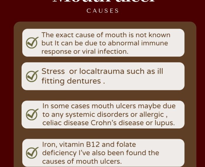 Mouth ulcer Causes