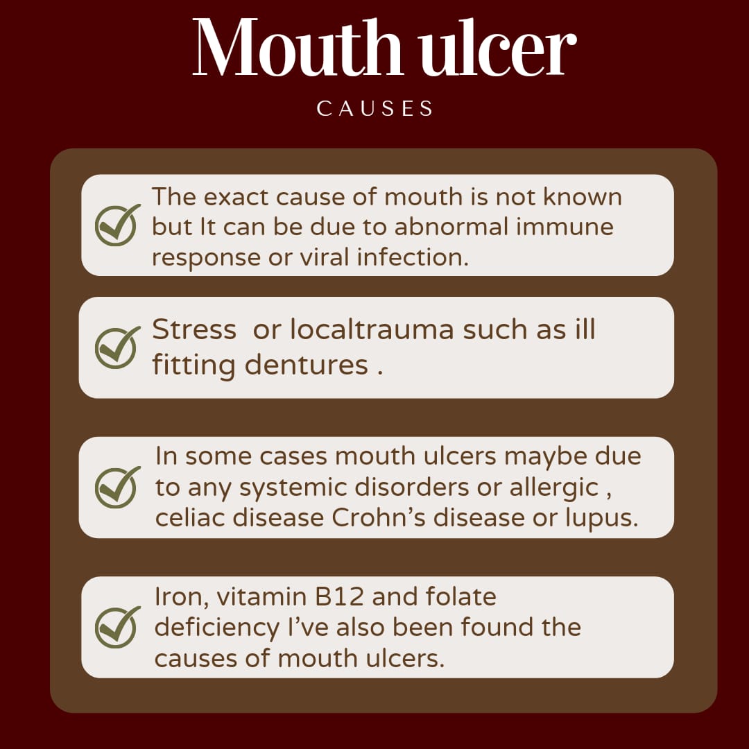 Mouth ulcer Causes