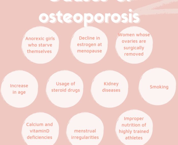 Causes of osteoporosis